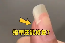 被撕开的指甲竟然还能够修复视频封面