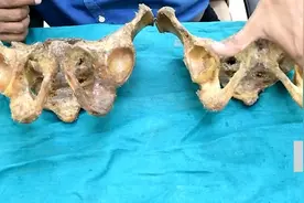 男女骨盆的区别视频封面