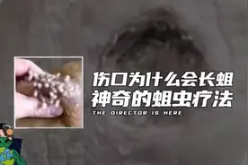 伤口为什么会长蛆， 神奇的蛆虫疗法