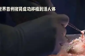 世界首例猪肾成功移植到活人体视频封面