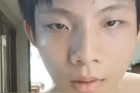 精神分裂症患者的健身打卡第十九天视频封面