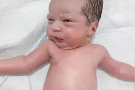 近亲结婚生出的孩子长什么样？宝宝出生后，宝妈不敢相信！