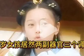 四川七岁女娃娃居然身上长了两副器官三个肾是变疫还是畸形？视频封面