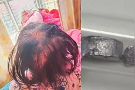 湖南3岁女孩铊中毒，医院证实系人为视频封面