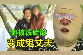 小伙为了过上甜蜜生活，惨遭蛇蝎美人泼了硫酸，妻子竟不离不弃！