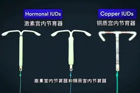 子宫宫内节育器的避孕原理，3D演示。。