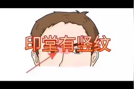 印堂有悬针纹会如何？视频封面