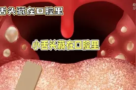 走进人体“小舌头”——悬雍垂视频封面