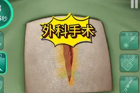 胆小勿看 #外科医生游戏#模拟外科医生游戏#模拟游戏推荐