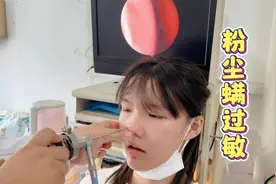 小娜子总打喷嚏揉眼睛，去医院检查确诊为过敏性鼻炎！视频封面