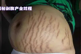 宝宝降生的全过程👶👩‍🍼😷