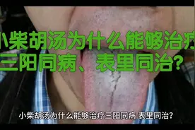 小柴胡汤为什么能够治疗三阳同病、表里同治？视频封面