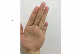 小手指短的人，都有什么样的性格特征？视频封面