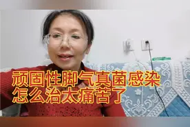 顽固性脚气真菌感染导致大脚趾肿疼，趾甲盖又一次脱落太痛苦了视频封面