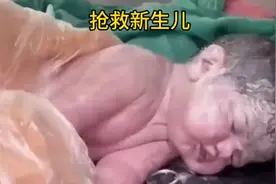 刚出生的宝宝因为宫内缺氧没有呼吸，医生奋力抢救视频封面