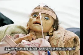 加沙儿童正被饥饿“吞噬”视频封面