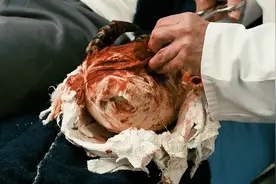 男人的手突然变成了龙虾手 #快看海外片   #第九区视频封面