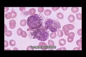 白血病是如何形成的