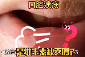 口腔溃疡，舌边起包，是“上火”，还是维生素缺乏？视频封面