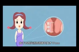 环扎手术过程记录，没有想象中的恐怖！