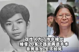双性人为传宗接代，接受20多次器官再造手术：非男非女，生不如死视频封面