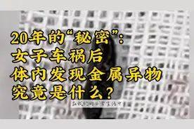 20年的“秘密”：女子车祸后体内发现金属异物，究竟是什么？视频封面