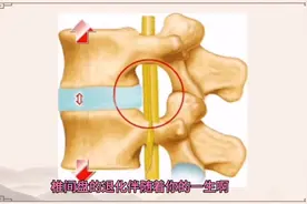 分享正骨独门绝技第十课：正常脊柱与异常脊柱的对比。