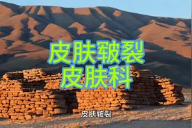 皮肤科:皮肤皲裂