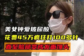 美女钟爱玻尿酸，花费45万疯狂打100多针，直至脸部变成发面馒头