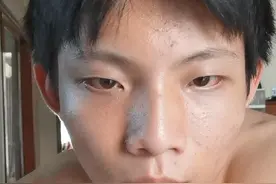 精神分裂症患者的健身打卡第二十三天视频封面