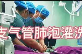 儿童支气管肺泡灌洗术视频封面