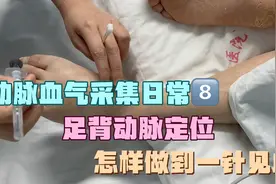 足背动脉的优点：位置浅，皮下脂肪少，周围组织少，不受体位限制视频封面