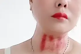 感冒自己揪痧视频封面