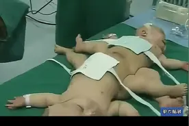 湖北·孝感--连体姐妹 #睡前故事视频封面