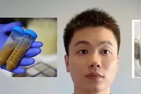 发财的好机会，正规医院捐粪便，300块一次，来看看你符合要求吗视频封面