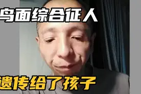 横店演员阿凡达是鸟面综合征人，孩子也被遗传到视频封面