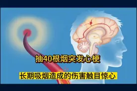 上海男子抽40根烟突发心梗。长期吸烟造成的伤害触目惊心