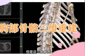 CT胸部骨骼三维重建，剖面展示切割