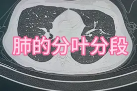 肺的分叶分段！需要的做个参考！视频封面