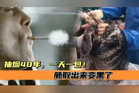 58岁男子抽烟40年，每天最少一包，肺取出来后彻底变黑！