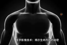 医学影像技术视频封面