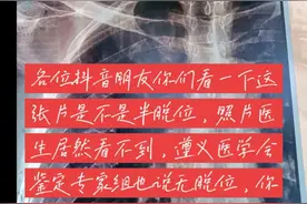 胸锁骨半脱位视频封面