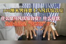 1米9男孩遗传父亲患上马凡氏综合症，什么症状？为什么说是天才病视频封面