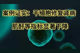 案例证实：干细胞修复肾病，肌酐等指标显著下降视频封面