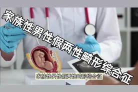 家族性男性假两性畸形综合征