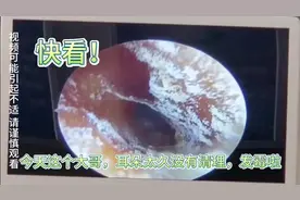 快看，这个年久失修的耳朵已经发霉了，看我怎么治它！关注不迷路