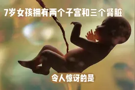 7岁女孩拥有两个子宫和三个肾脏视频封面