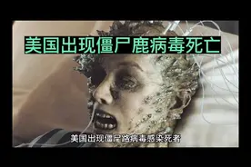 美国出现僵尸鹿病毒死亡，此前有攻击行为，感染死亡率为100%