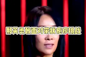 那英患有带状疱疹视频封面