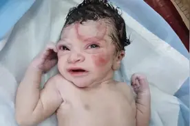 刚出生的婴儿惨遭“破相”，宝爸的一句指责让医生火了视频封面